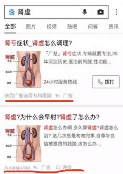 无耻！百度的竞价排名又出来作恶了，每天躺赚千万